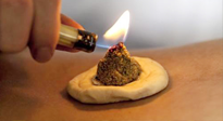 【艾灸知識(shí)】十大常見艾灸不良反應(yīng)，及處理方法！建議收藏！